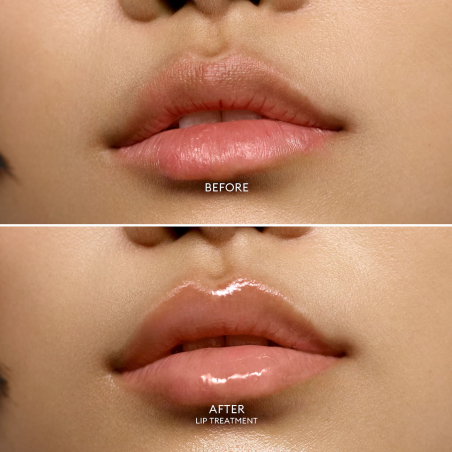 Lip Treatment Hydrating Lip Balm