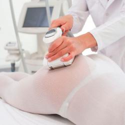 E-LPG 20 MINUTOS LOCALITZADA